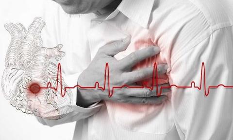 الفرق بين الأعراض الشائعة للنوبة القلبية والذبحة الصدرية والاحتشاء القلبي
