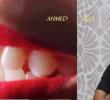 الدكتور/ أحمد عادل شعبان: جراحة زراعة الأسنان لم تعد مؤلمة، ولا تستغرق وقت طويل بدخول الأجهزة الرقمية